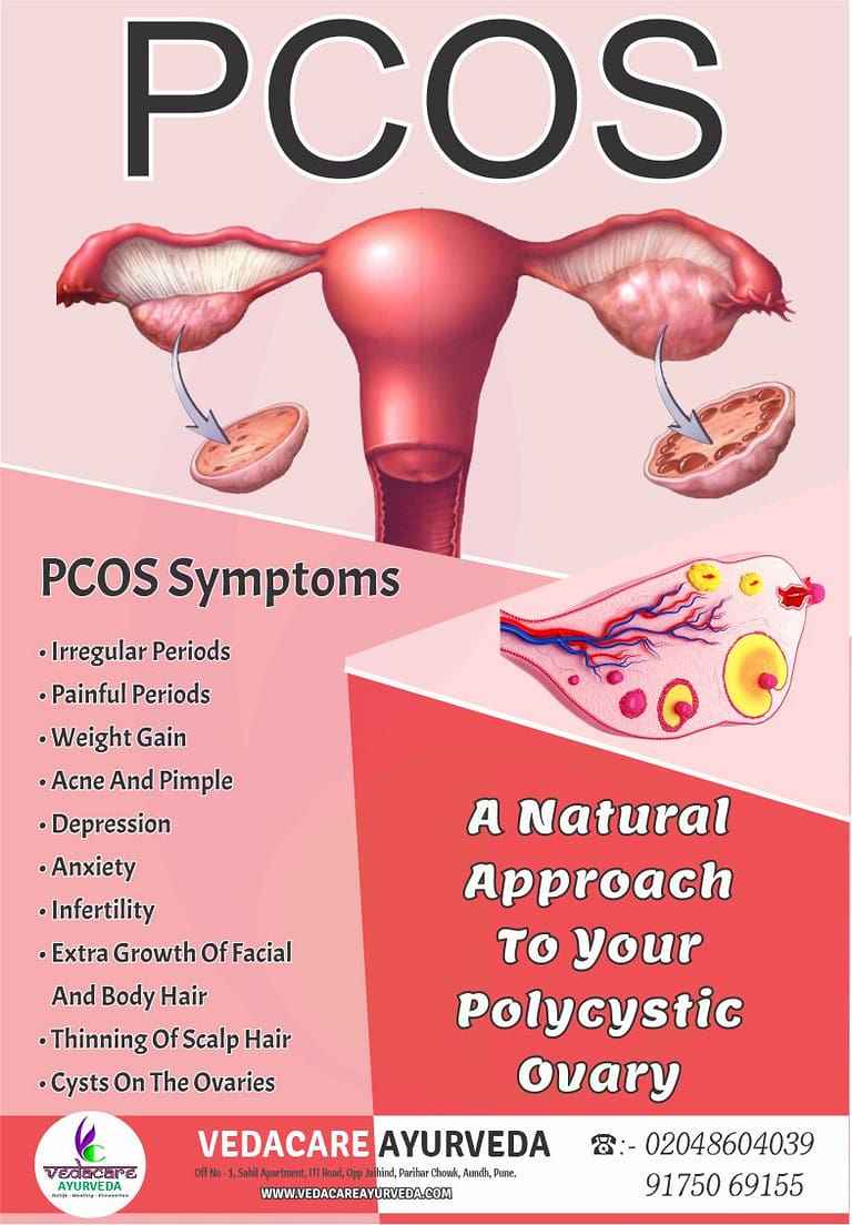 PCOS ayurvedic treatment aundh pune