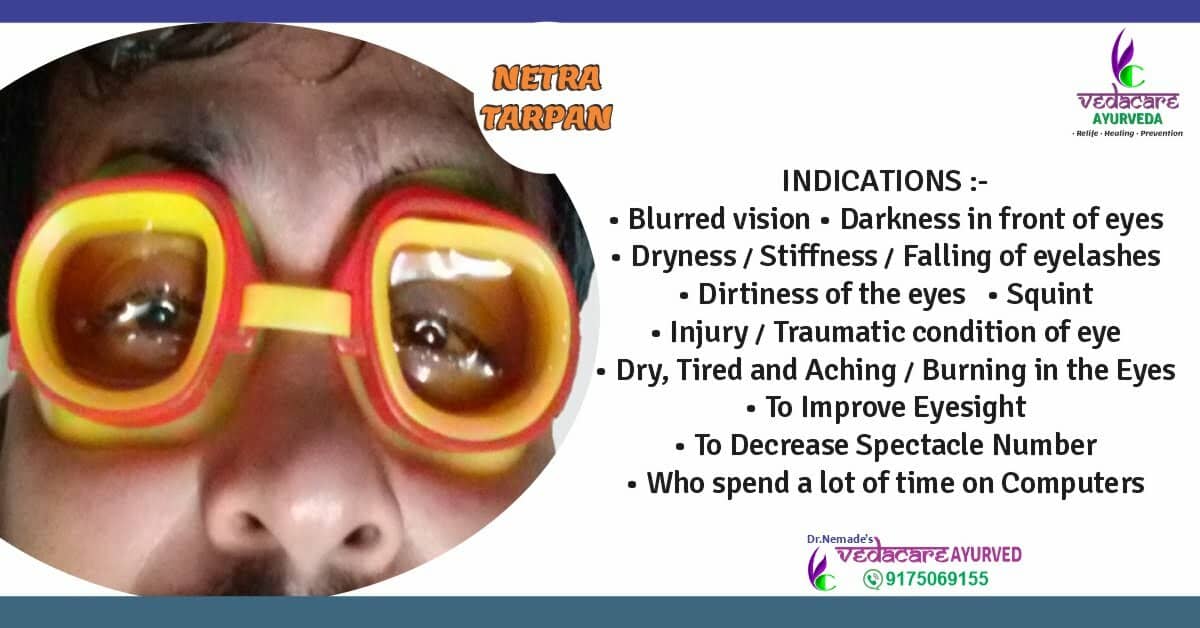 Netra-Tarpan-Netra-Basti-ayurvedic-treatment-Eye