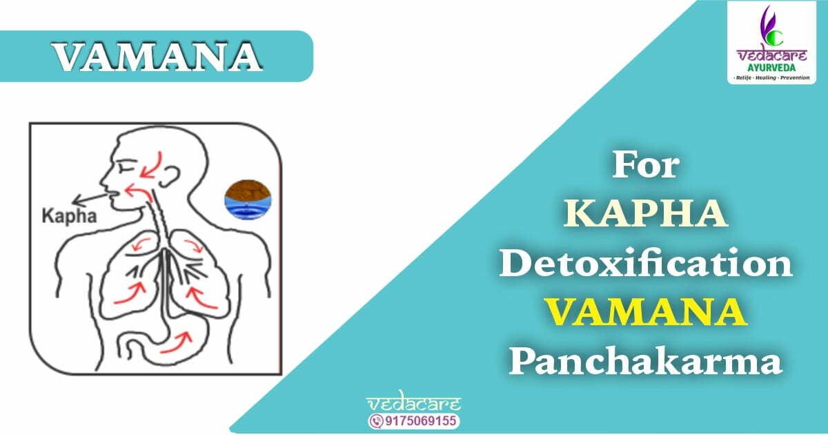 vaman panchakarma